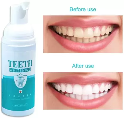 Latibule Teeth Whitening